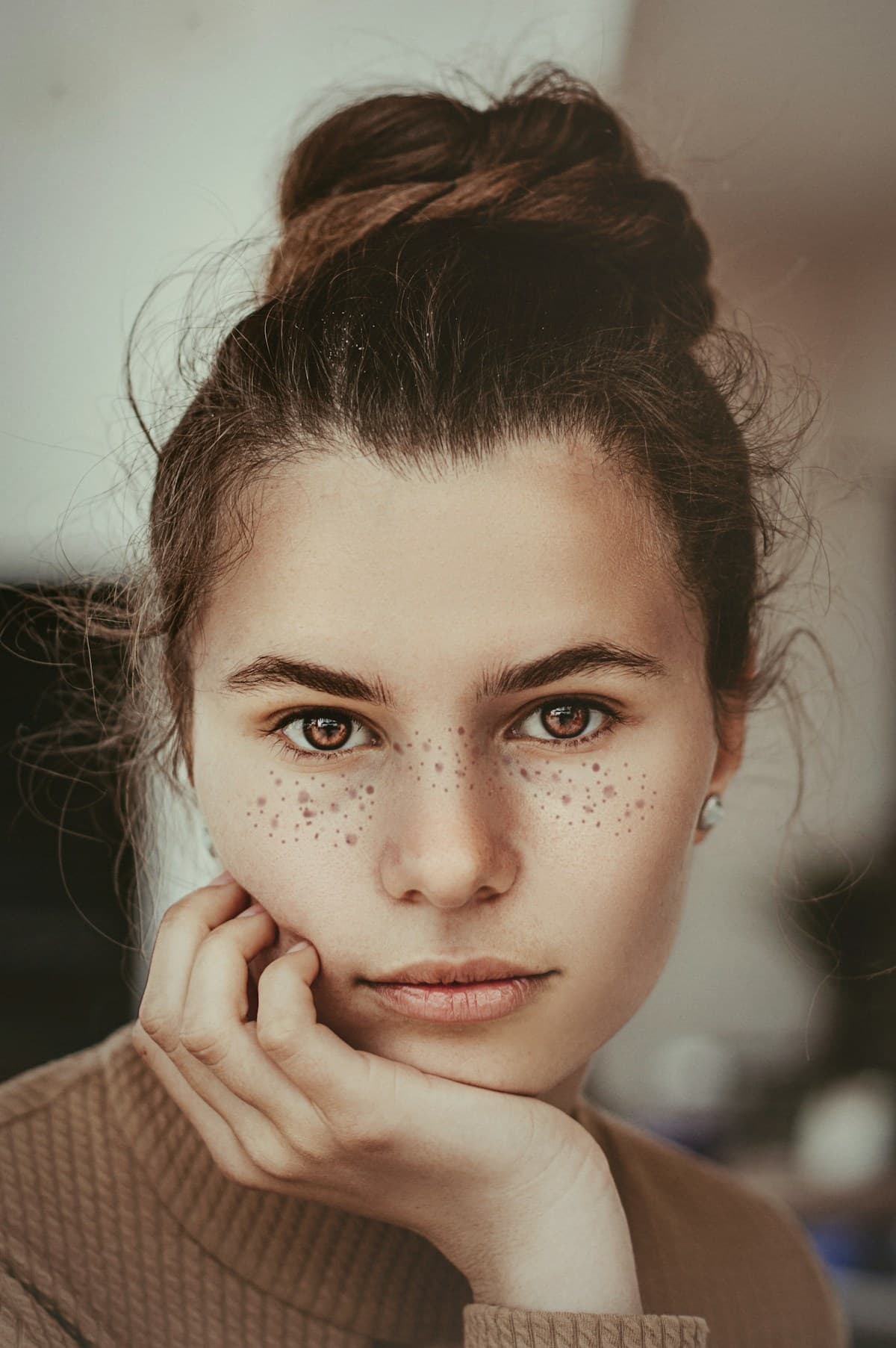 How To Reduce Crow's Feet Naturally
