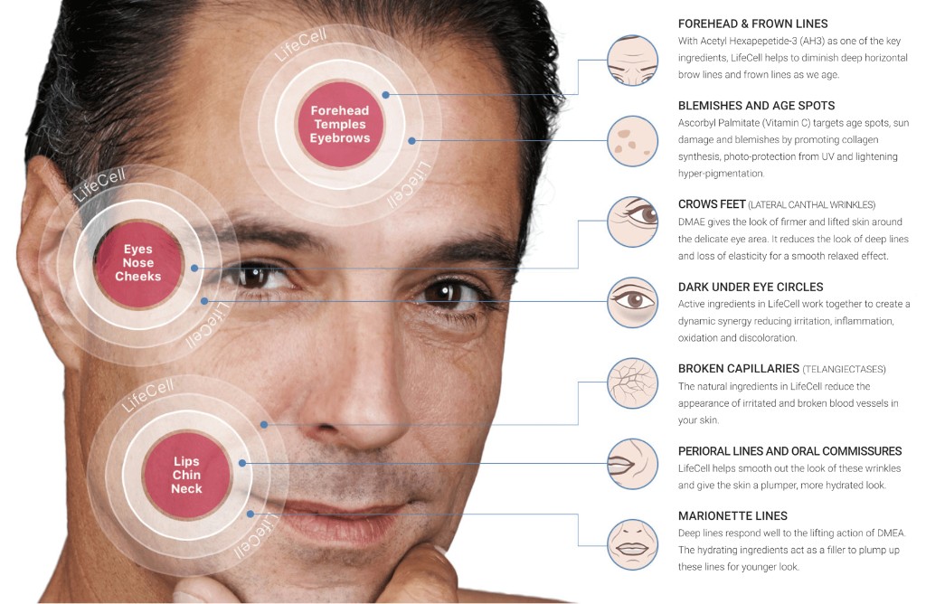 LifeCell target areas on face — forehead, eyes, cheeks, lips, chin and neck
